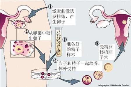 关于代怀选性别包生男孩